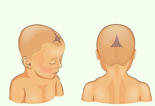 Hình ảnh thóp trước và thóp sau của trẻ sơ sinh
