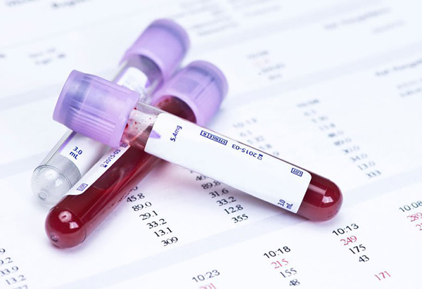 Trong xét nghiệm công thức máu gồm nhiều loại chỉ số.