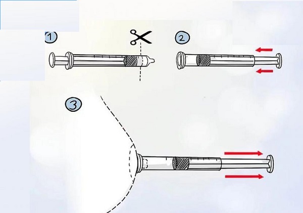 Cách làm ống tiêm kéo núm vú bị tụt