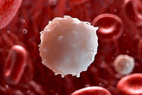 Các biện pháp hỗ trợ điều trị bệnh ung thư máu ở trẻ em bao gồm những gì?
