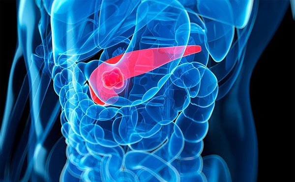 Dấu hiệu nhận biết ung thư tuyến tụy như thế nào?