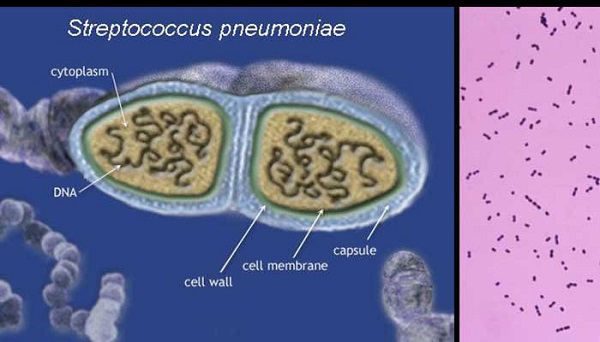 Hình ảnh vi khuẩn Streptococcus pneumoniae dưới kính hiển vi
