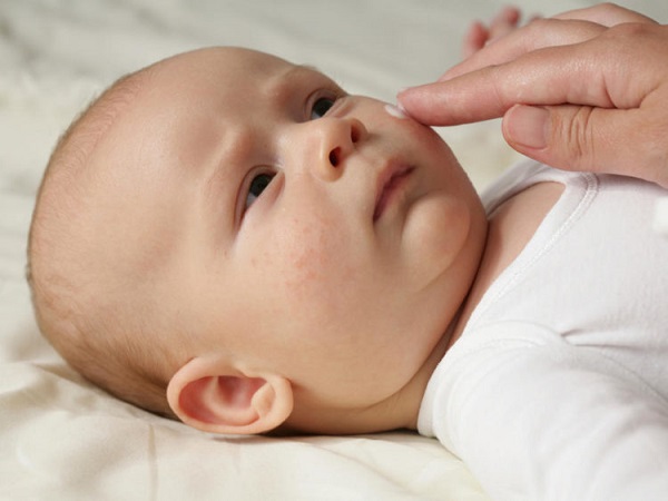 Trẻ sơ sinh bị viêm da mủ cần được sử dụng kem dưỡng ẩm