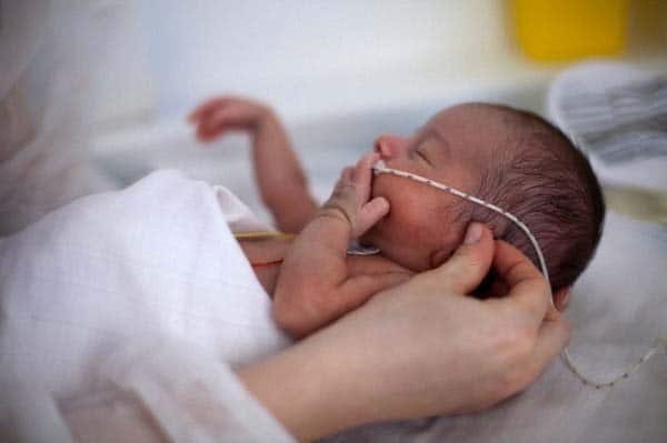 Trẻ sơ sinh bị viêm phổi có biểu hiện mệt mỏi, ngủ li bì, mắt lờ đờ