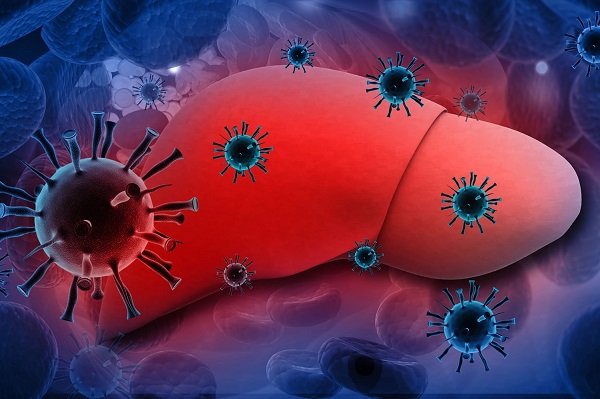 Viêm gan C là bệnh nhiễm trùng do virus gây tổn thương gan.
