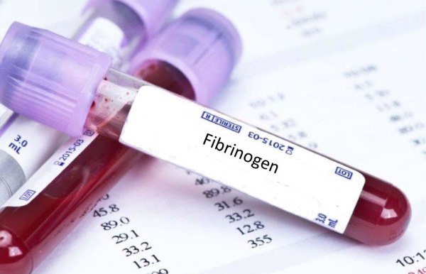 Xét nghiệm Fibrinogen