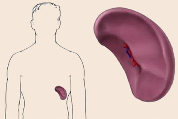  bệnh cường lách là hội chứng gây ra bởi sự to lên của lách cùng với sự sụt giảm của tế bào máu